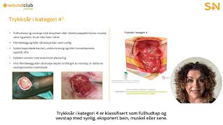 Wound Club Online / modul 7: Trykksår (5 minutter)