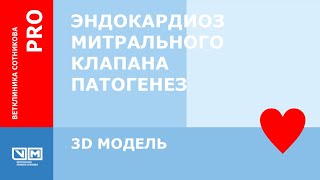 Эндокардиоз митрального клапана. Патогенез