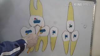 Molar class I ,angle classification in orthodontics