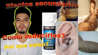 Efectos secundarios de minoxidil para la barba efectos secundarios del minoxidil