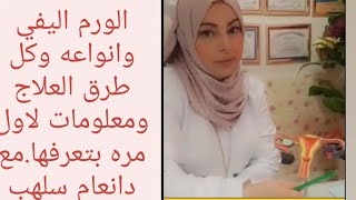 الورم اليفي وانواعه وكل طرق العلاج ومعلومات لاول مره بتعرفها. مع الدكتوره انعام سلهب