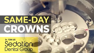 Same-day Crowns | In house lab