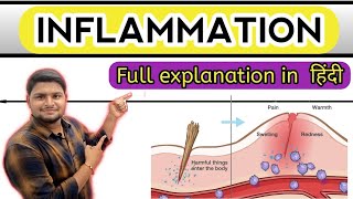 INFLAMMATION ||expalin in हिंदी by saurabh sir||#disease_msn_medical_nursing