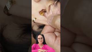 Dr.Natacha, earwax traitement symptoms satisfying.