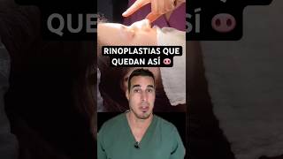 Se OPERAN la NARIZ y quedan PEOR 🐽 - Esta RINOPLASTIA le cambió hasta los LABIOS