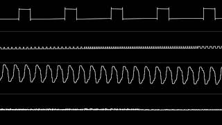 Jonne Valtonen and Aleksi Eeben - "Project S-11 - Lewak Forest" [Oscilloscope View]