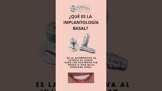 ¿QUÉ ES LA IMPLANTOLOGÍA BASAL?