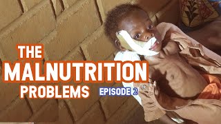 MALNUTRITION PROBLEMS EPISODE 2