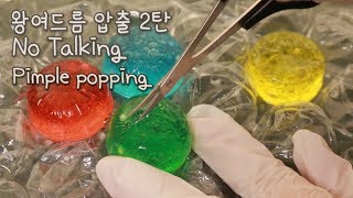 ASMR 알록달록 왕여드름 압출 2탄 👩🏻‍⚕️ No talking pimple popping (+미니여드름)