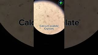 Calcium Oxalate crystal in urine | urine Analysis | Urine microscope