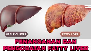 MENANGANI FATTY LIVER