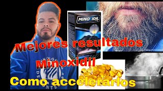 🧔🧬Minoxidil accelerar mejores Resultados como accelerar resultados minoxidil?