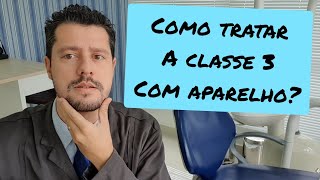 Como tratar a Classe 3 com aparelho?