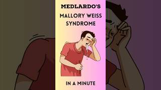 Mallory Weiss Syndrome in a Minute! 🩺💡