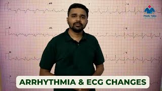 Arrythmia of Heart | ECG | Heart Block | ExtraSystole | Paroxysmal Tachycardia | Fibrillation