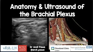 Anatomy & Ultrasound of the Brachial Plexus