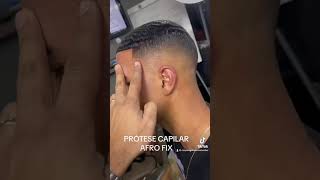 PRÓTESE CAPILAR AFRO FIX #protesecapilar #calvicie #proteseafro