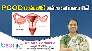 PCOD రావడానికి అసలు కారణాలు ఇవే  | Reason for PCOD Problems | Boon Fertility