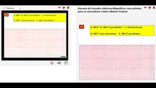 29 Gincana de traçados eletrocardiográficos