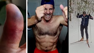 VLOG 23.000 - Broken Thumb - Upper Body Strength - Skiing