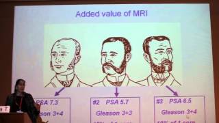 Prostate MRI Clinical Case Discussion - Tamar SELLA Part 1