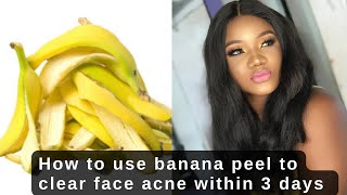 How to clear face acne & pimples in 3 days #acne #fyp #acnetreatment #howto #selfcare #viral #tiktok