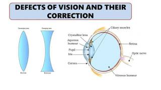 Human Eye, Defects and Corrective Measures | आँखों की रोशनी बढ़ाने और चश्मा उतारने के उपाय