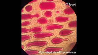 Osmosis in Onion Cells