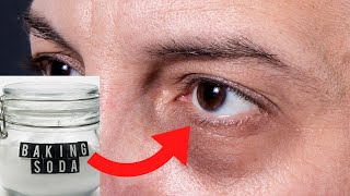 Why You Should Put Baking Soda Under Your Eyes? - Health Benefits of Baking Soda For Eye!!