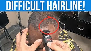 How to Line Up a Receding Hairline Without a Pushback!