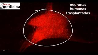 Trasplante de neuronas humanas a un cerebro de ratón