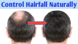 Baal jhadne se rokne ke upay | Alopecia areata natural treatment