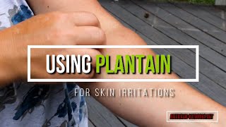 Plantain For Ticks, Chiggers, Burns, Ivy