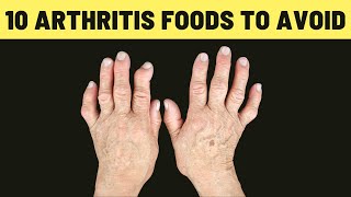 10 Foods To Avoid If You Have Arthritis | VisitJoy