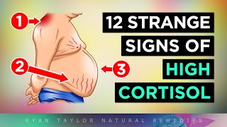 12 Strange Signs of HIGH CORTISOL