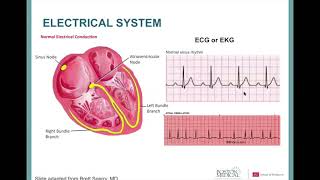 Cardiac Amyloidosis: A Patient’s Perspective