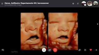 Novas Tecnologias 3D em Medicina Fetal