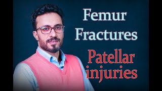 13 Patellar injuries