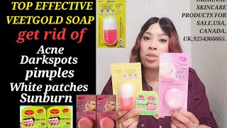 TOP WHITENING SOAPS(VEETGOLD)