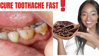 HOW TO INSTANTLY STOP A TOOTHACHE AT HOME REMEDY||Clove oil for Toothache#cloves