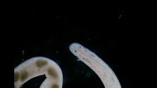 Flatworm With Eggs Under Microscope