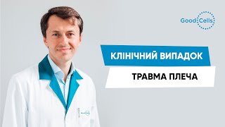 Біль у плечі. Клітинна терапія в Good Cells. Відгук пацієнта.