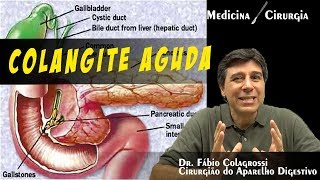 COLANGITE AGUDA