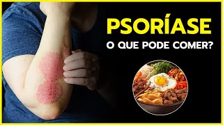 ALIMENTAÇÃO E PSORÍASE [O QUE VOCÊ PRECISA SABER]