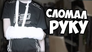 Сломал Руку на Эксперименте!