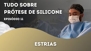 Silicone causa estrias?