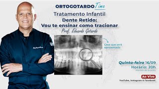 Dente Retido: Vou te ensinar como tracionar no Tratamento Infantil