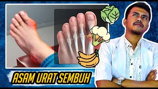 5 Makanan Penurun Asam Urat Cepat dan Ampuh