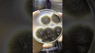 #microbiology #bacteria #fungus #biology #microbes #science #future #microbes #scienceexperiment