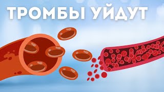 Чистим Сосуды и Сердце Единственный Рабочий Способ! (Это Надо Знать)